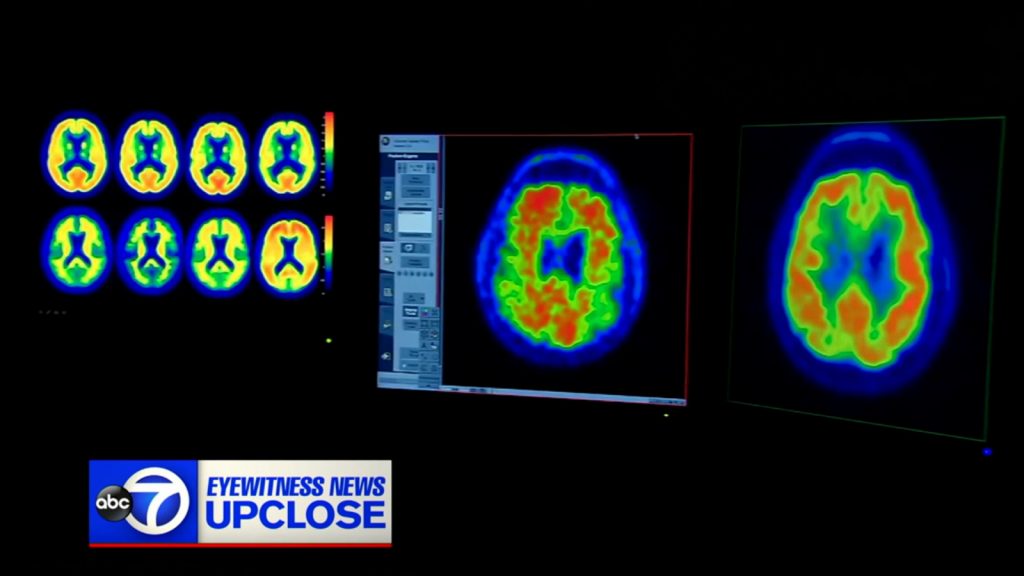 Up Close with Bill Ritter: Understanding Alzheimer's disease after NJ Sen. Andy Kim opens up about father's diagnosis