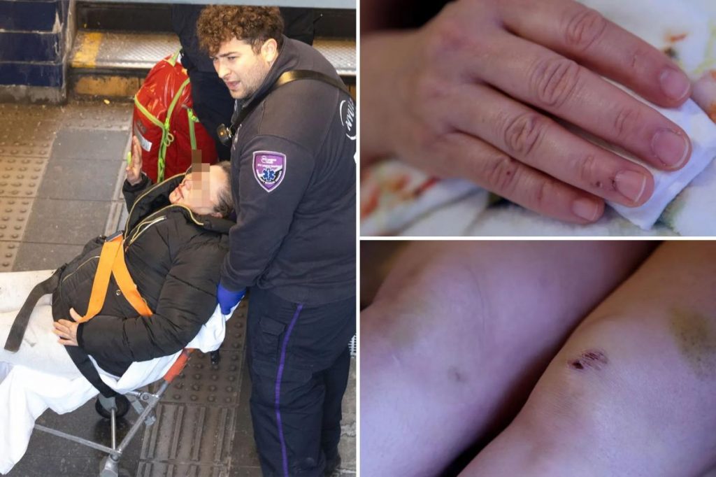 Woman shoved onto NYC subway tracks by crazed attacker slams Mamdani’s safety plan Woman shoved onto NYC subway tracks by crazed attacker slams Mamdani's safety plan