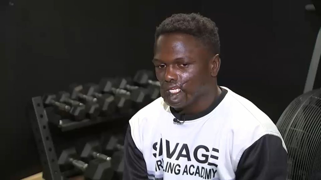 Long Beach high school wrestling star overcomes odds after surviving chimpanzee attack in the Congo at 6 years old Long Beach high school wrestling star overcomes odds after surviving chimpanzee attack in the Congo at 6 years old