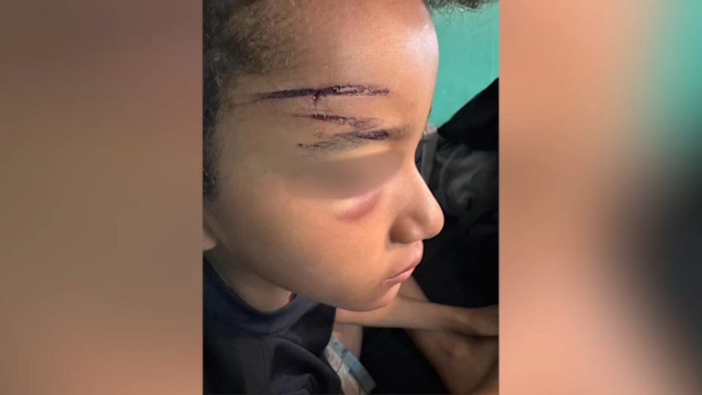 Bronx 9-year-old child punched in face in Grant Park in Claremont; 15-year-old suspect arrested