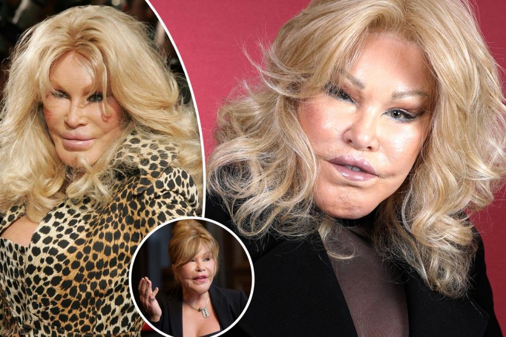 New York needs more wackos like the surgery addict Catwoman