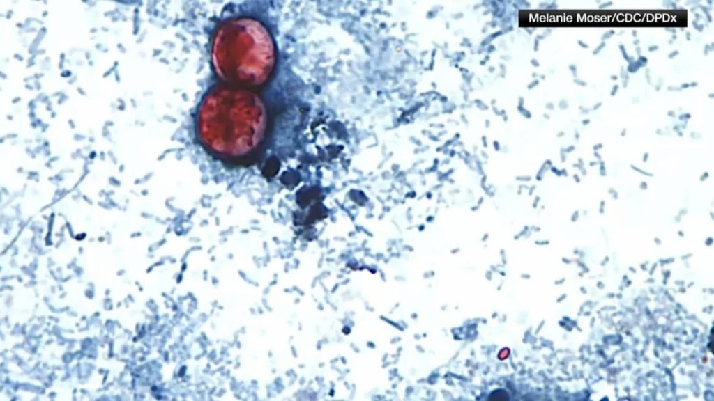 Cyclosporiasis stomach parasite: NYC sees three-fold increase in parasitic infections compared to last year Cyclosporiasis stomach parasite: NYC sees three-fold increase in parasitic infections compared to last year