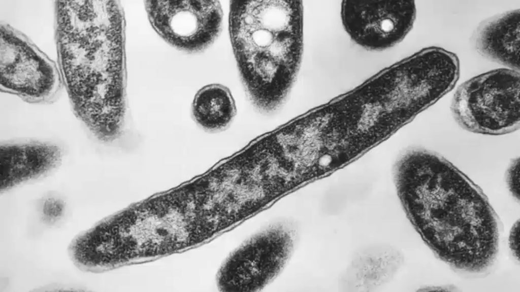 Legionnaires’ outbreak: 2nd victim to die in UES cluster was Air Force veteran, businessman Legionnaires' outbreak: 2nd victim to die in UES cluster was Air Force veteran, businessman