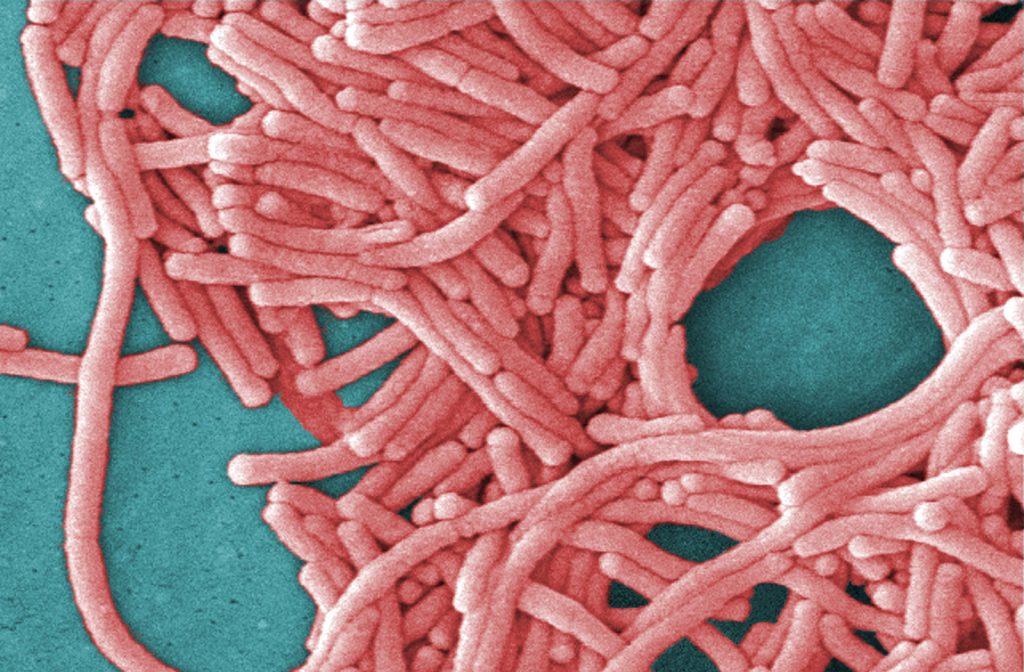 Two cases of Legionnaires’ disease prompt Upper East Side investigation in New York City Two cases of Legionnaires' disease prompt Upper East Side investigation in New York City